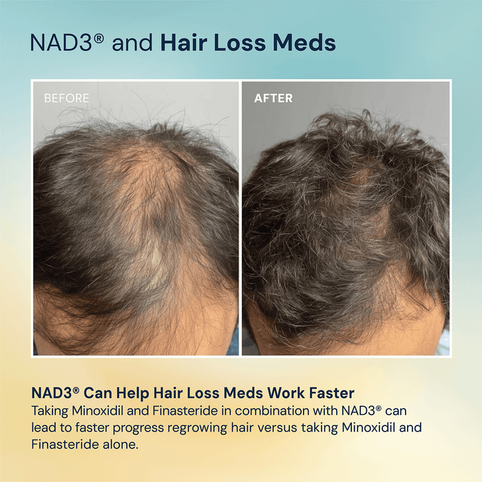 NAD3® 60 • An All Natural NAD+ Booster® Dietary Supplement (1 Month Supply)